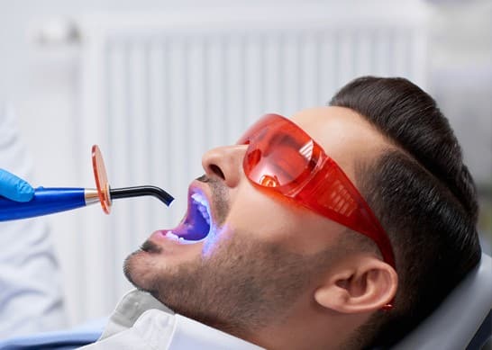 During The Dental Filling Procedure